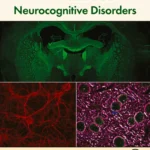 خرید و دانلود نسخه کامل کتاب 
HIV-Associated Neurocognitive Disorders