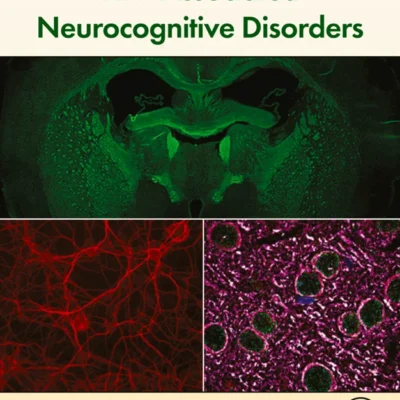 خرید و دانلود نسخه کامل کتاب 
HIV-Associated Neurocognitive Disorders