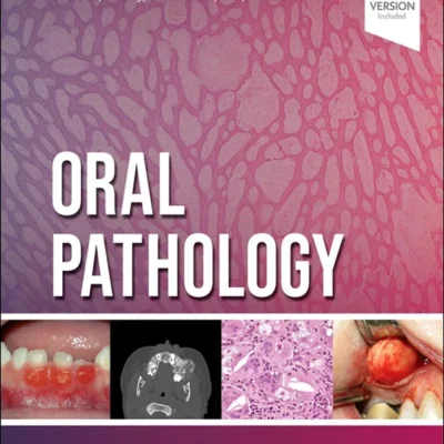 خرید و دانلود نسخه کامل کتاب 
Oral Pathology 3rd Edition