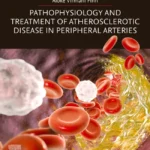 خرید و دانلود نسخه کامل کتاب 
Pathophysiology and Treatment of Atherosclerotic Disease in Peripheral Arteries