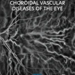 خرید و دانلود نسخه کامل کتاب 
Retinal and Choroidal Vascular Diseases of the Eye