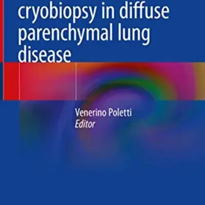 خرید و دانلود نسخه کامل کتاب 
Transbronchial cryobiopsy in diffuse parenchymal lung disease