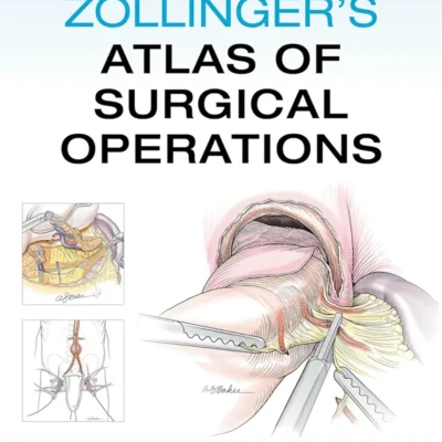 خرید و دانلود نسخه کامل کتاب 
Zollinger's Atlas of Surgical Operations 11th Edition
